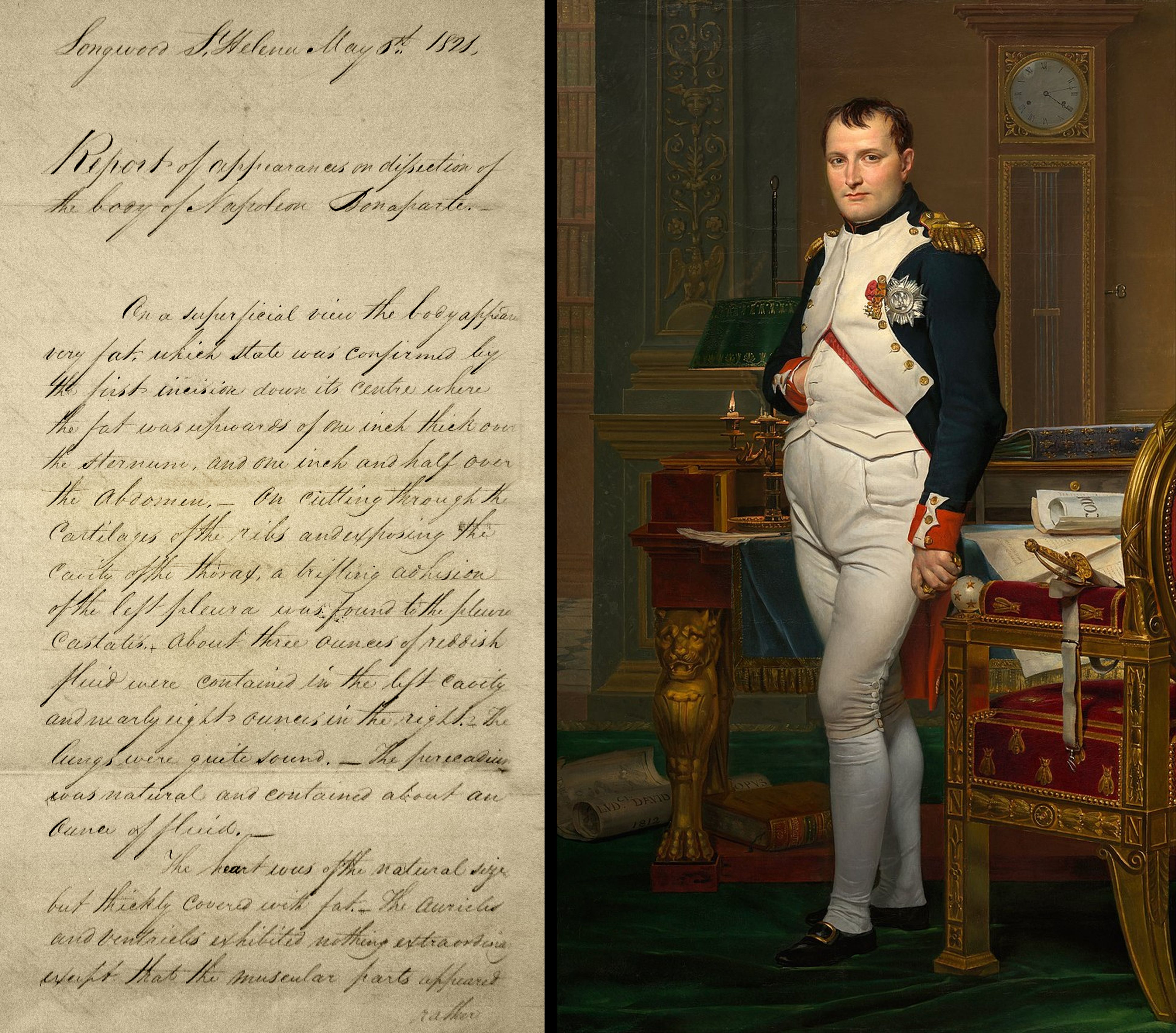 post-mortem_of_napoleon_bonaparte.jpg