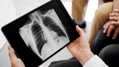 x ray