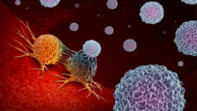Oncology 
