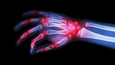 rheumatology 