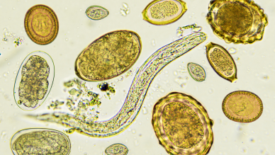 Parasite slide