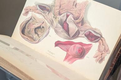 An open book showing a colour illustration of a womb and ovaries