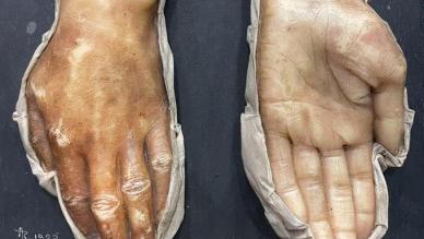 Wax moulage
