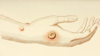 Edward Jenner