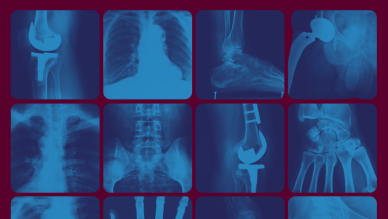 x rays
