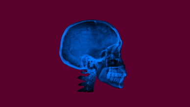 Skull