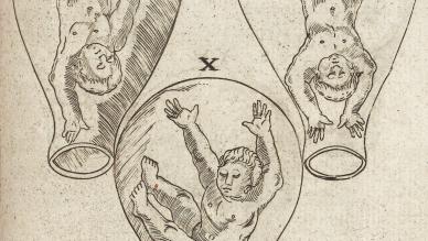 Eucharius Rösslin’s midwifery manual titled The Byrth of Mankynde, Otherwyse Named the Womans Booke