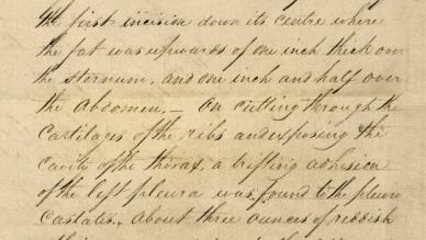 Napoleon Bonaparte's Post Mortem