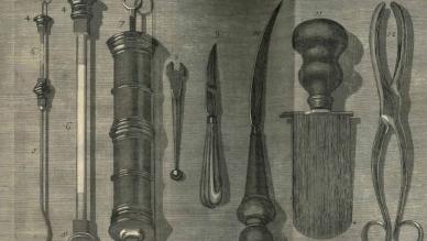 Lithotomy
