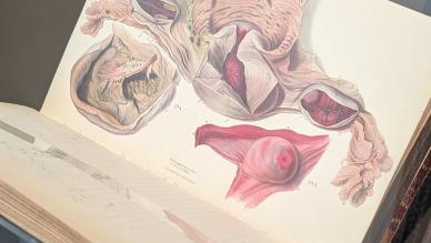 An open book showing a colour illustration of a womb and ovaries