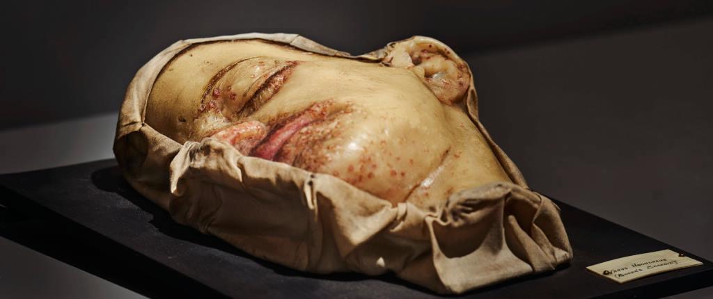wax_moulage.jpg